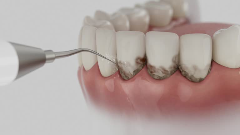 Reliable Invisalign Clear Aligners contractor in Combee Settlement, FL by Smile Center Dentistry